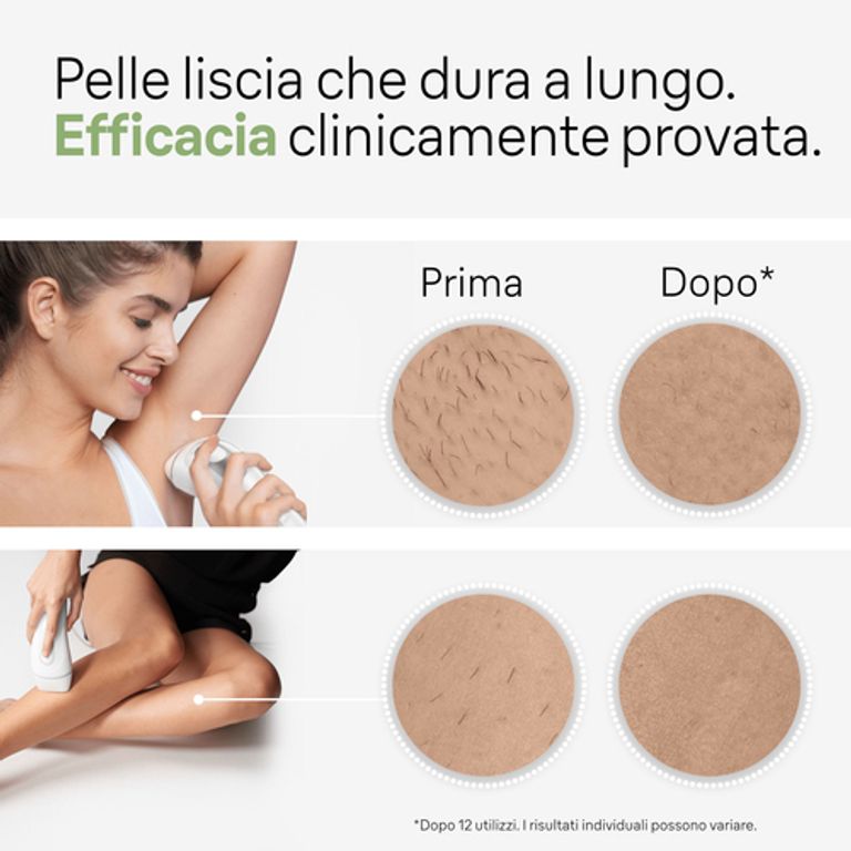 Braun Silk-expert Pro Silk expert Pro 3 PL3020, Epilatore A Luce Pulsata Donna, Per La Rimozione Permanente Dei Peli Visibili A Casa Tua, Bianco/Argento_BRAUN_4_big-image